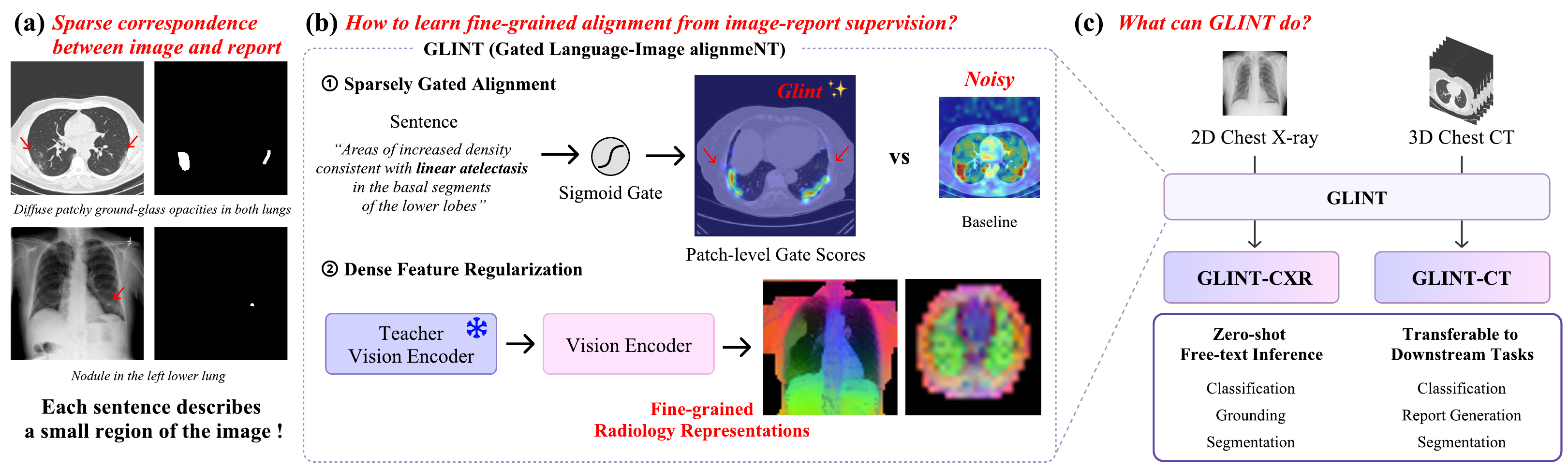 GLINT overview: sparse image-report correspondence, sigmoid-gated alignment versus a noisy dense baseline, and the GLINT-CXR / GLINT-CT family