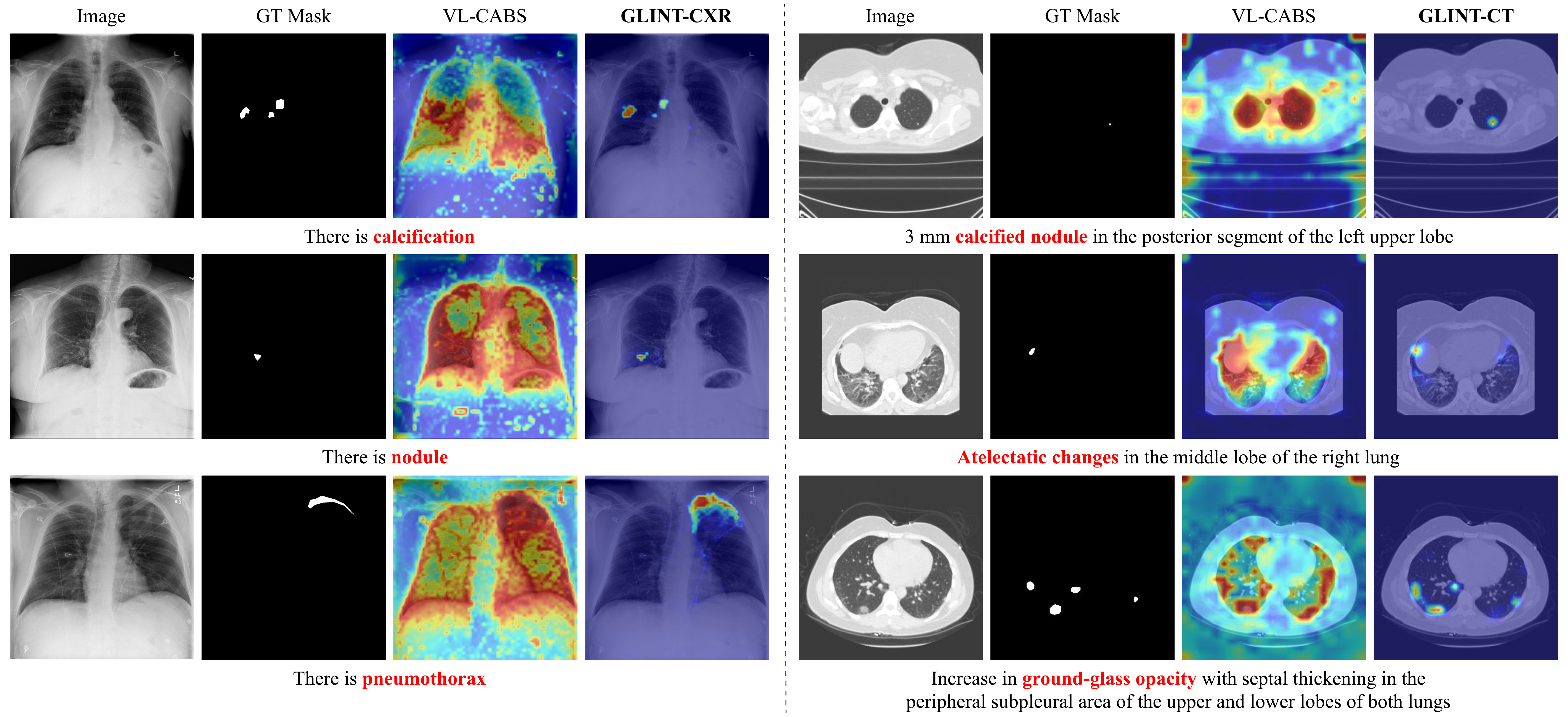 Free-text queries highlighting findings on chest X-rays and CT volumes with sparse gate maps